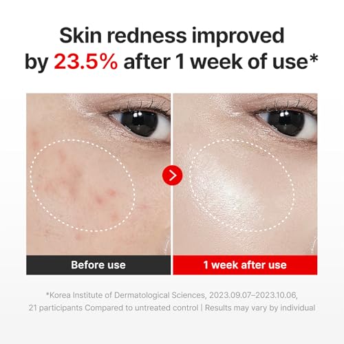 CENTELLIAN 24 Madeca Cream Time Reverse, TECA Anti-Aging Moisturizer